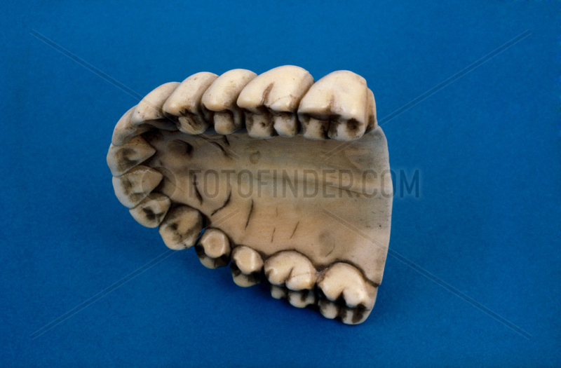 Upper denture,  1780-1850.