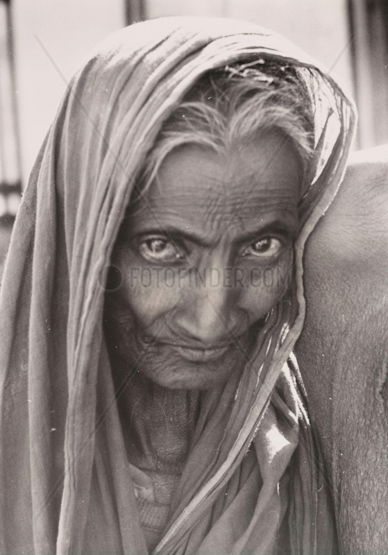 The partly blind wife of a beggar,  East Pakistan,  1963.