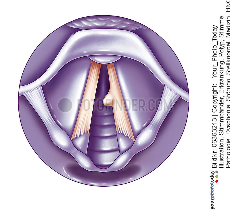 VOCAL CORD,  DRAWING Illustration