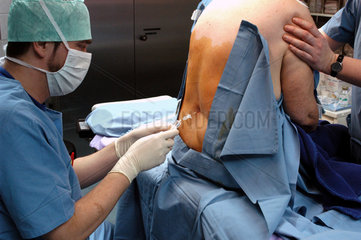 Anaesthesist im OP bei der Anlage eines Periduralkatheters