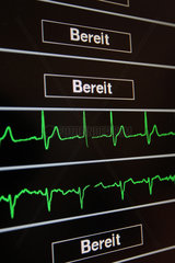 Flensburg  Deutschland  Monitor auf einer kardiologischen Station
