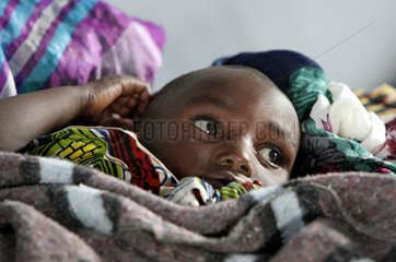 Goma  Demokratische Republik Kongo  an Cholera erkranktes Kind