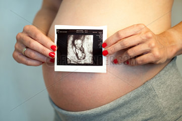 Berlin  Deutschland  schwangere Frau mit Ultraschallbild