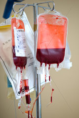 Berlin  Deutschland  Bluttransfusion