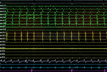 Berlin  farbige Linien eines EKG auf einem Monitor