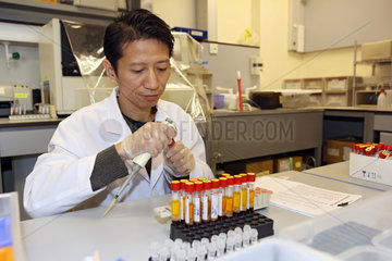 Hong Kong  China  Laborant untersucht eine Urinprobe
