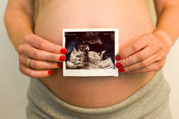 Berlin  Deutschland  schwangere Frau mit Ultraschallbild