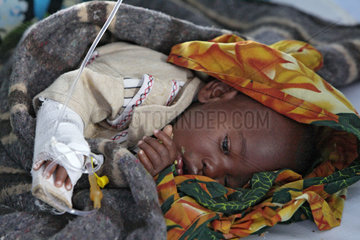Goma  Demokratische Republik Kongo  ein an Cholera erkranktes Kind