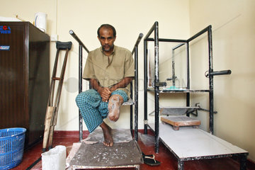 Kundasale  Sri Lanka  beinamputierter Mann sitzt in einem Behandlungsraum