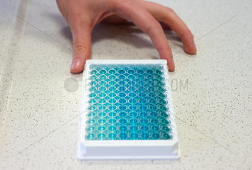 Laborarbeit: Proben in einer 96er PCR Platte innerhalb der ELISA-Diagnostik