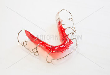 Berlin  Deutschland  Zahnspangen gegen Zahn- und Kiefer-Fehlstellungen
