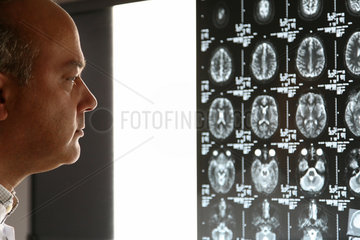 Berlin  Deutschland  Dr. med. Thomas Muehlberger schaut sich Kopf-MRT-Bilder an