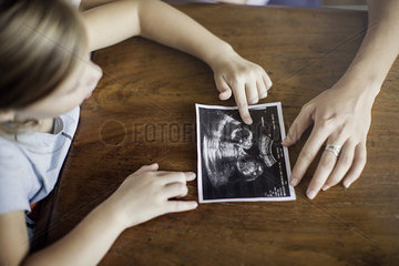 Girl looking at ultrasound photo of her new sibling to be