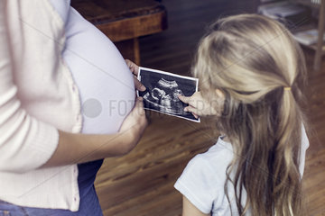 Mother showing daughter ultrasound photo