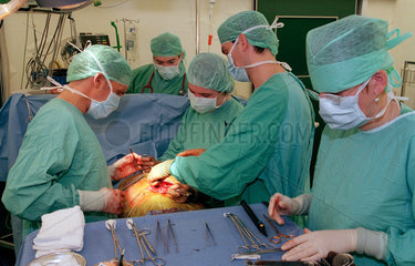 Operation am Bauch von einem Chirurgenteam