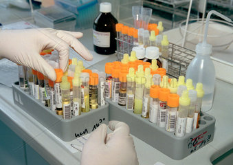 Sortieren von Laborproben in einem klinischen Labor