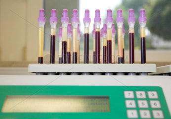 Essen  Deutschland  Messung der Blutsenkung in einem Zytologielabor