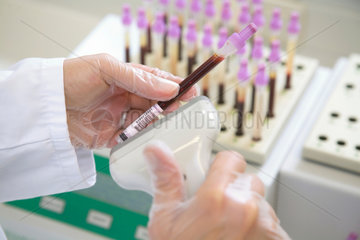 Essen  Deutschland  Zytologieassistentin scannt Blutproben fuer die Blutsenkung ein