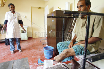 Kundasale  Sri Lanka  beinamputierter Mann sitzt in einem Behandlungsraum