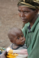 Goma  Demokratische Republik Kongo  Mutter haelt ihr krankes Kind im Arm