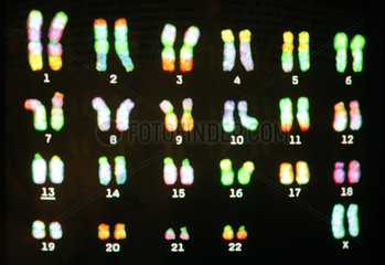 Die menschlichen Chromosomen auf einem Monitor