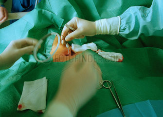 Ambulanter Eingriff auf einer Intensivstation an der Luftroehre eines Patienten