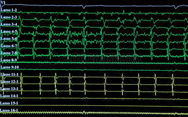 Berlin  farbige Linien eines EKG auf einem Monitor