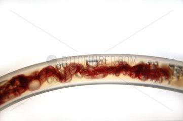 flexible tube with blood