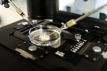 Berlin  Deutschland - Kuenstliche Befruchtung nach der ICSI-Methode (Intrazytoplasmatische Spermien Injektion) unter dem Mikroskop. Das Spermium wird in die Eizelle mit einer Mikronadel injiziert.