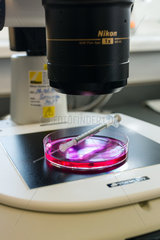 Berlin  Deutschland - Kuenstliche Befruchtung nach der ICSI-Methode (Intrazytoplasmatische Spermien Injektion). Unter dem Mikroskop werden geeignete Eizellen ausgewaehlt.