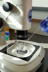 Berlin  Deutschland - Kuenstliche Befruchtung nach der ICSI-Methode (Intrazytoplasmatische Spermien Injektion). Unter dem Mikroskop werden geeignete Eizellen ausgewaehlt.