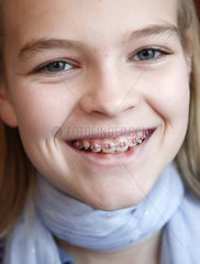 Hamburg  Deutschland  Portrait eines lachenden elfjaehrigen Maedchens mit Zahnspange