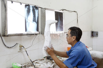Orthopaedietechniker modelliert an einem Gipsabdruck in einer Orthopaediewerkstatt