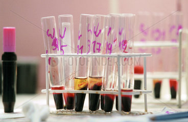 Blutproben in einem Reagenzglas.