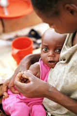Krankes Kleinkind im Fluechtlingslager Viana  Angola.