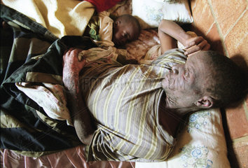Bettlaegeriger Aids Patient im Matabeleland