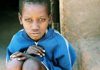 Portrait eines jungen Aidspatienten