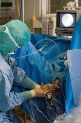 Laseroperation an der Prostata  Berlin