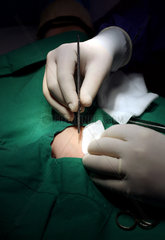 Chirurg mit Skalpell bei einer ambulanten Operation