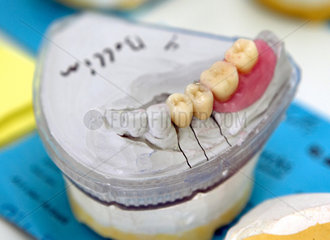 Kronen und Spangen beim Zahnarzt