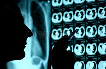Berlin  Arzt beurteilt Roentgen-und CT-Aufnahmen