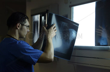 Arzt sieht sich an einem Leuchtkasten eine Roentgenaufnahme an