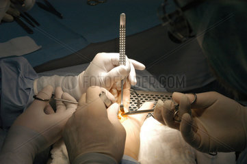 Operateure im Operationssaal bei einer Handoperation