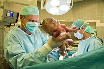 Berlin  Deutschland  ein Arzt bringt ein Baby per Kaiserschnitt zur Welt