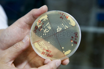 CHINA-SCIENCE-SYNTHETIC YEAST CHROMOSOMES (CN)