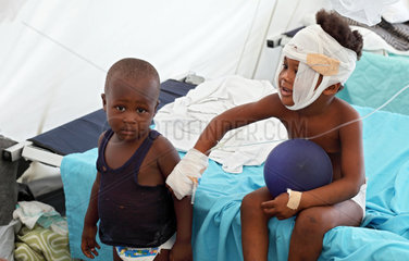 Carrefour  Haiti  ein Kind mit Brandverletzung im Patientenzelt