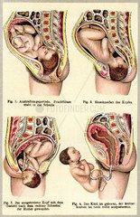 Illustration Schwangerschaft  um 1905