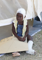 Carrefour  Haiti  ein Maedchen mit verbundenem Kopf und Gipsbein