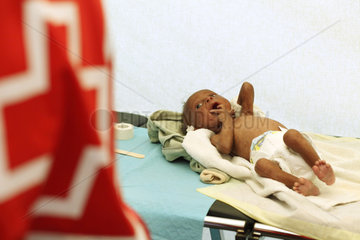Carrefour  Haiti  ein krankes Kleinkind liegt auf einer Trage und schreit