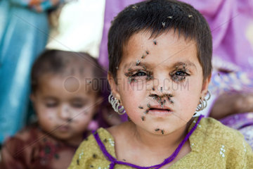 Lujja Khan Jakrani  Pakistan  Portrait eines Kindes mit Fliegen im Gesicht